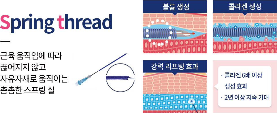 근육 움직임에 따라 끊어지지 않고 자유자재로 움직이는 촘촘한 스프링 실 강남피부과-강남역피부과 아름다움을 드리는 자신감 강남피부과 미앤미