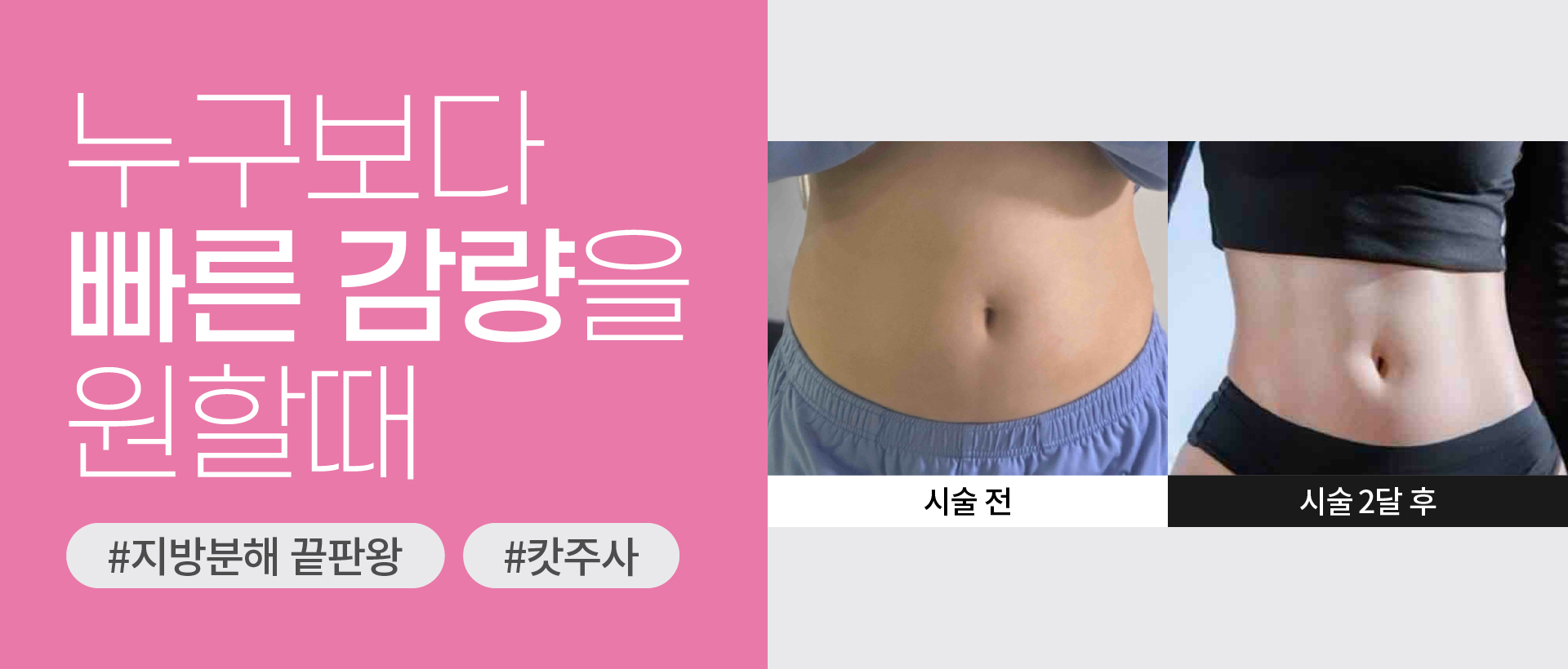 캇주사2